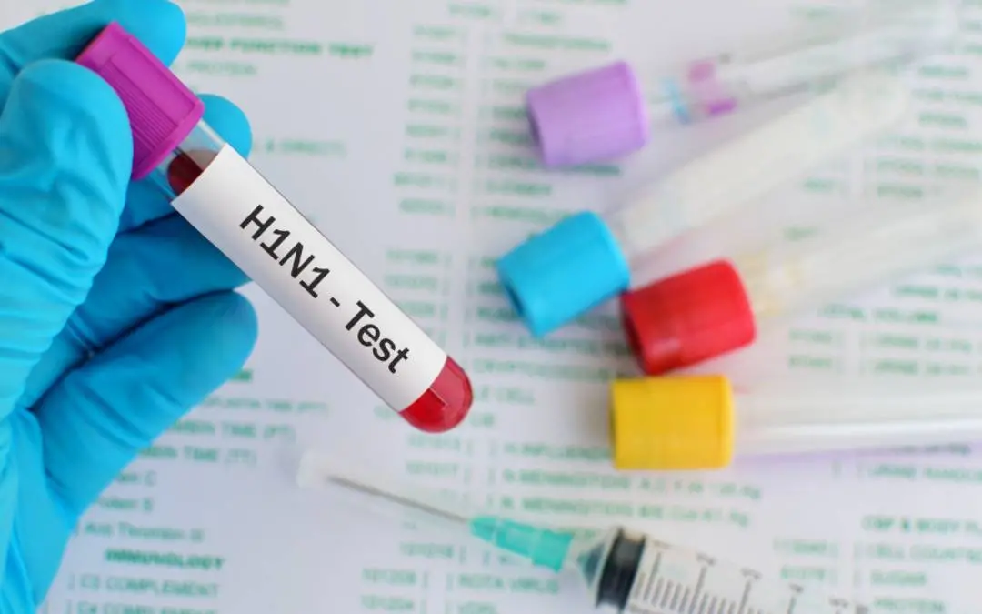 H1N1 Testing